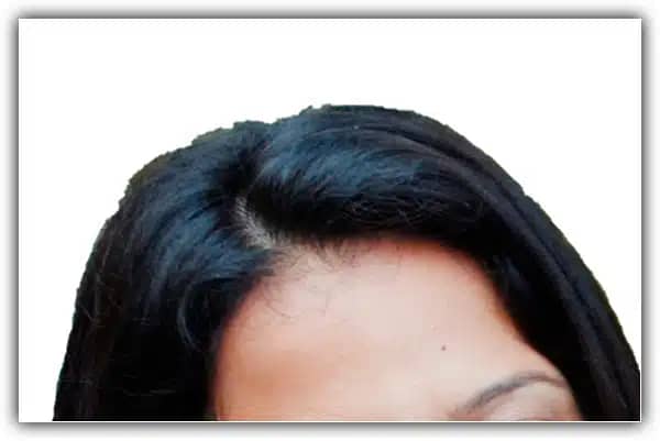 Outra área com picos de cortes.