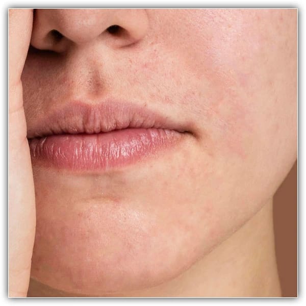 Dê um zoom na imagem para verificar se as correções foram aplicadas.